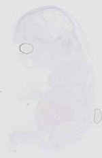EMAGE:18516