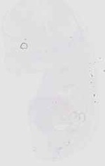 EMAGE:18516