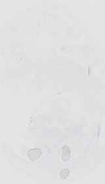 EMAGE:18516