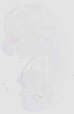 EMAGE:18516