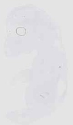 EMAGE:18516