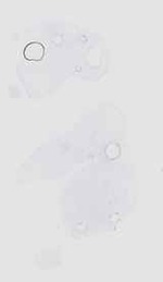 EMAGE:18516