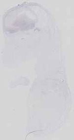 EMAGE:18559