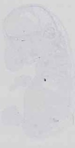 EMAGE:18563