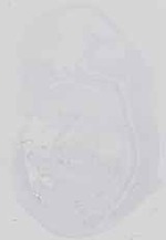 EMAGE:18573