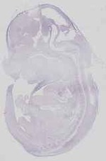EMAGE:18576