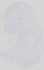 EMAGE:18578