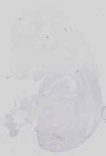 EMAGE:18578
