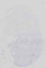 EMAGE:18578