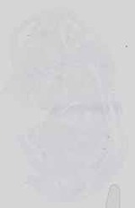 EMAGE:18578