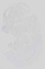 EMAGE:18578