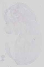 EMAGE:18578