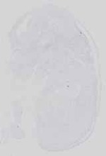 EMAGE:18578