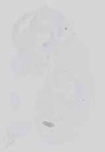 EMAGE:18578