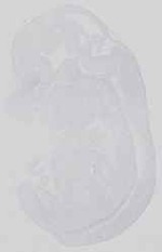 EMAGE:18579