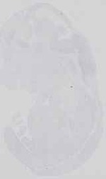 EMAGE:18580