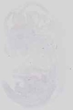 EMAGE:18590