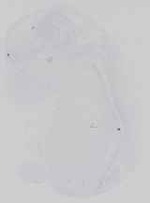 EMAGE:18616