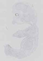 EMAGE:18634