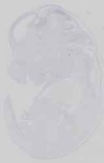 EMAGE:18636