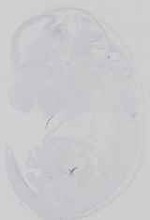 EMAGE:18636