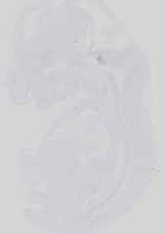 EMAGE:18642