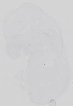 EMAGE:18670
