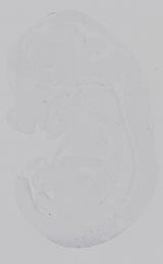 EMAGE:18689