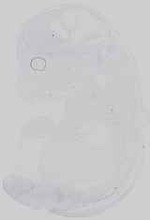 EMAGE:18697