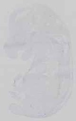 EMAGE:18707