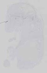 EMAGE:18707