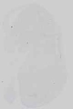 EMAGE:18708