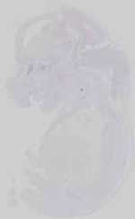 EMAGE:18708