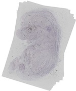 EMAGE:18708