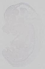 EMAGE:18712
