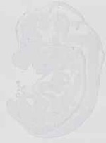 EMAGE:18746