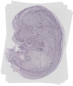 EMAGE:18808