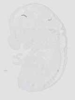EMAGE:18812