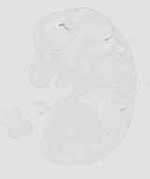 EMAGE:18812