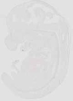 EMAGE:18819