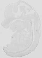 EMAGE:18844