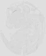 EMAGE:18966