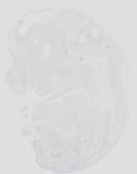 EMAGE:18966