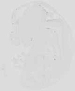 EMAGE:18989