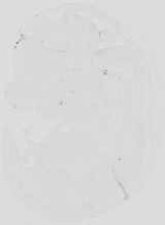 EMAGE:18989