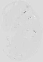 EMAGE:18989