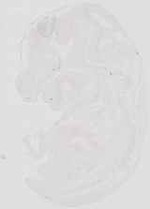 EMAGE:19002