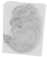 EMAGE:19004