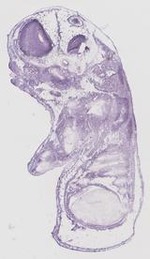 EMAGE:19007