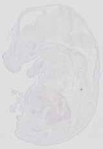 EMAGE:19033